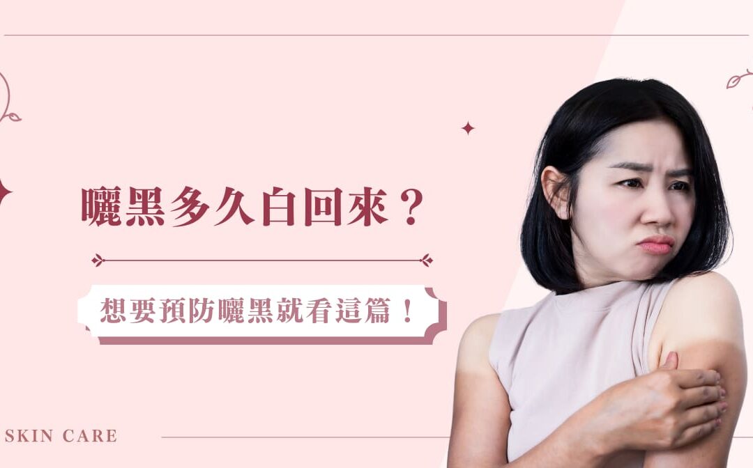 曬黑多久白回來？想要預防曬黑就看這篇！