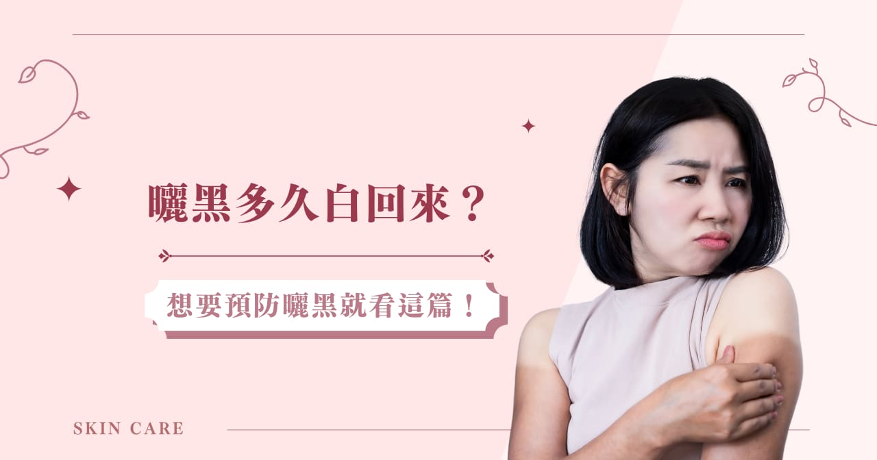 曬黑多久白回來？想要預防曬黑就看這篇！