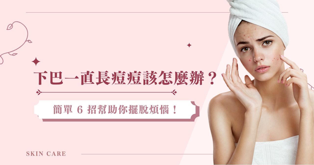 下巴一直長痘痘該怎麼辦？簡單 6 招幫助你擺脫煩惱！