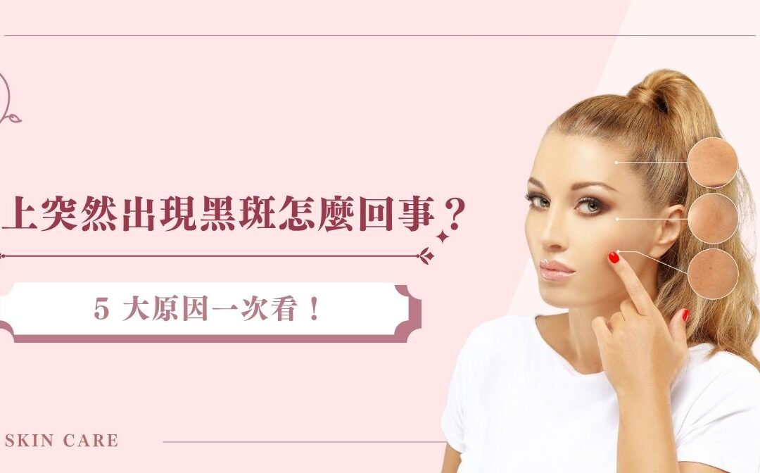 臉上突然出現黑斑怎麼回事？5 大原因一次看！