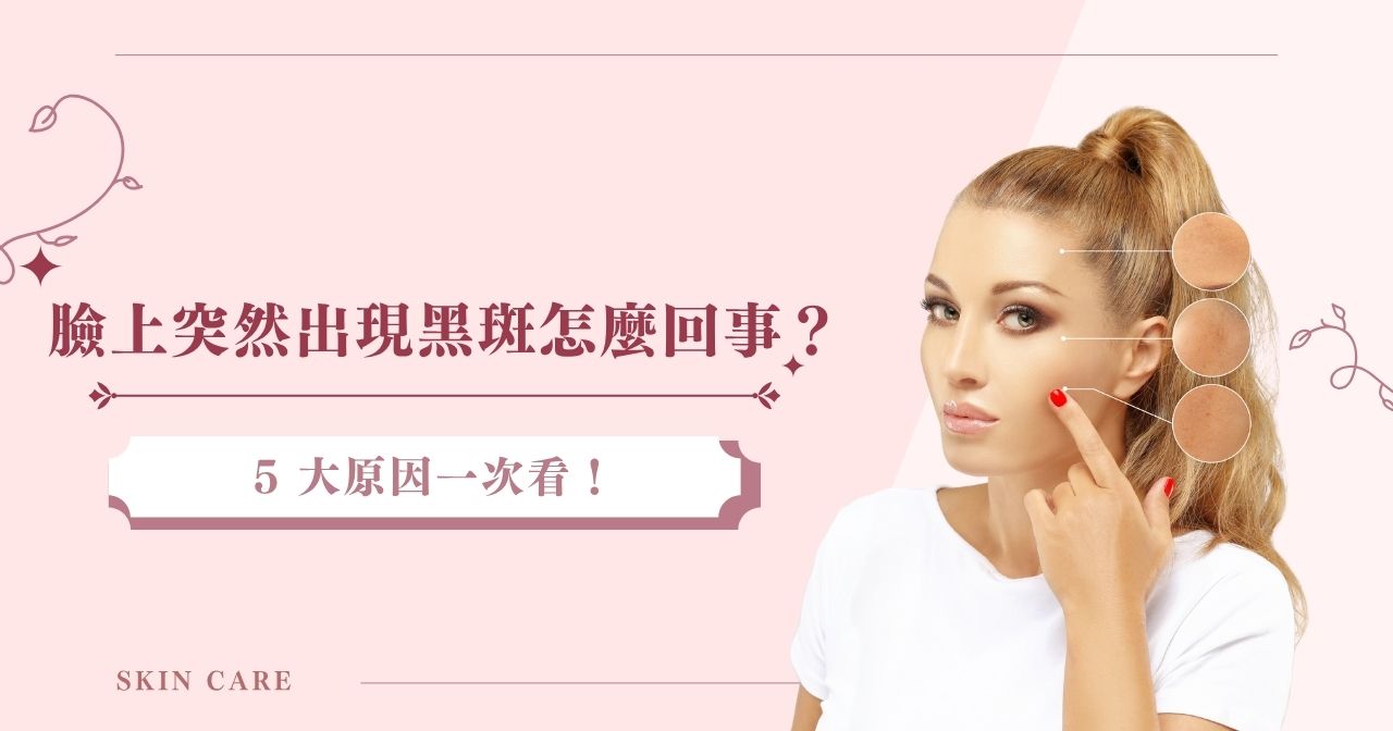 臉上突然出現黑斑怎麼回事？5 大原因一次看！