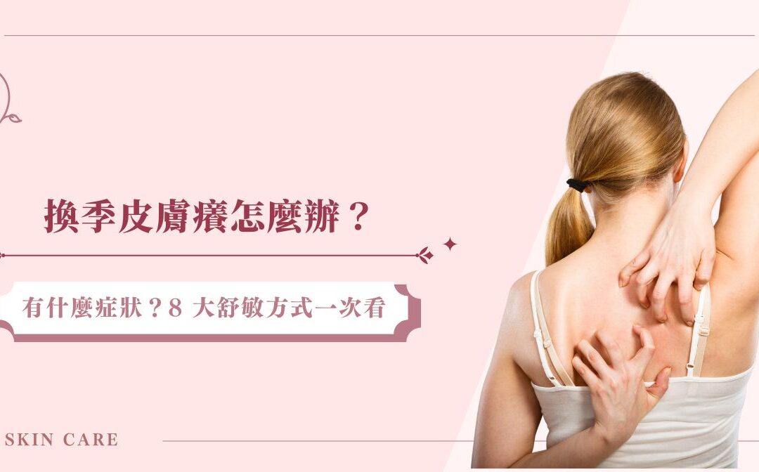 換季皮膚癢怎麼辦？有什麼症狀？8 大舒敏方式一次看