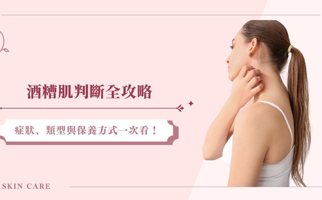 酒糟肌判斷全攻略：症狀、類型與保養方式一次看！