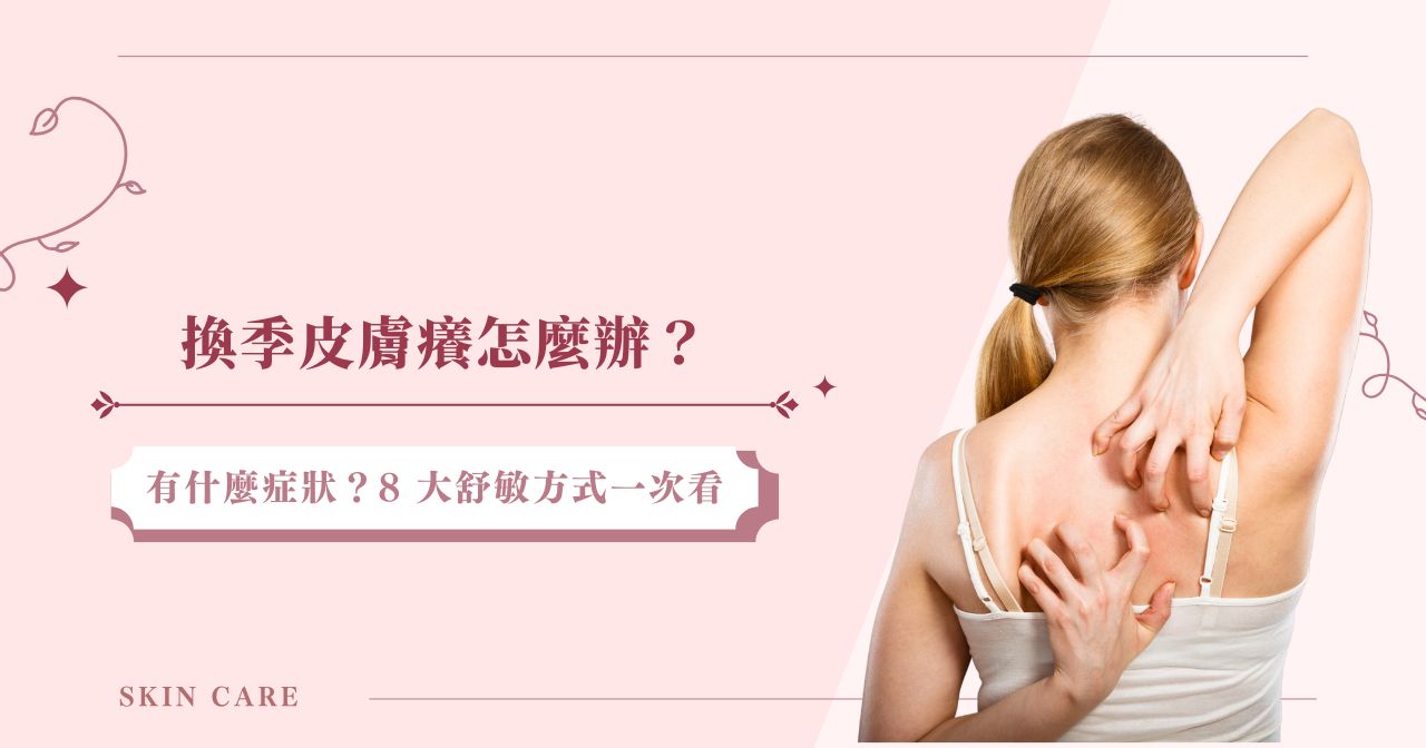 換季皮膚癢怎麼辦？有什麼症狀？8 大舒敏方式一次看