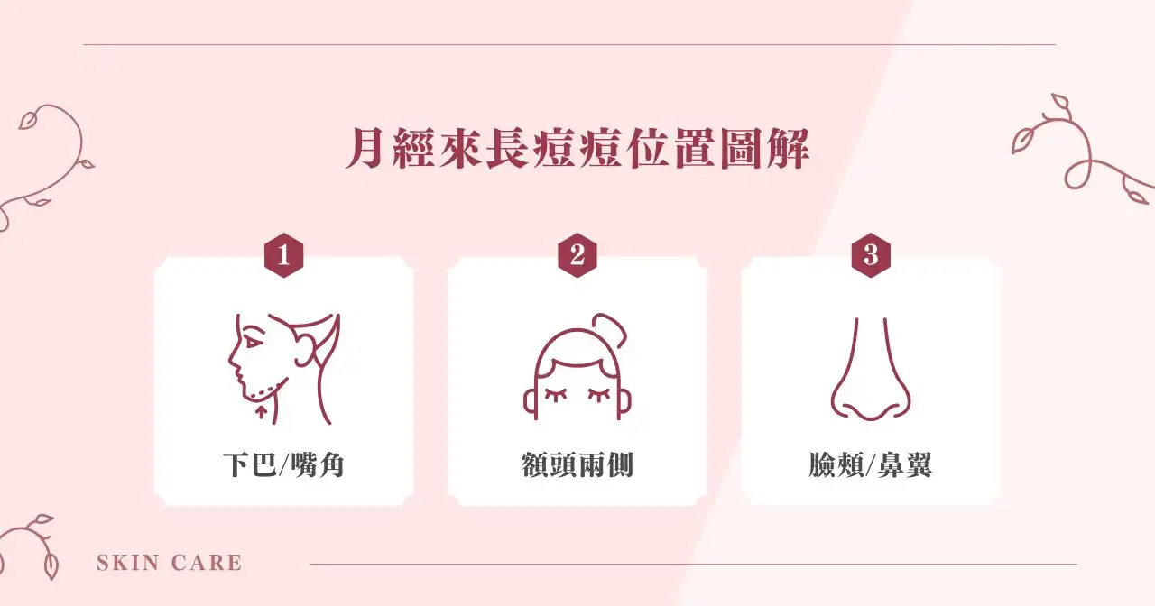 月經來長痘痘位置圖解