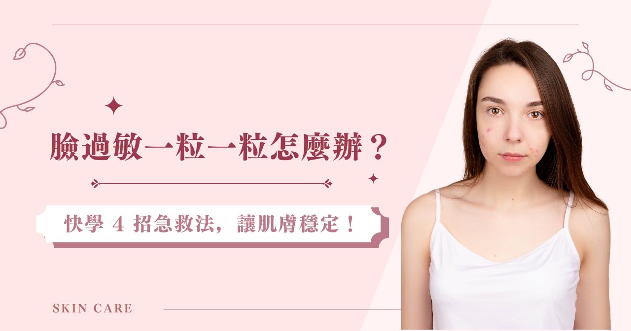 臉過敏一粒一粒怎麼辦？快學4招急救法，讓肌膚穩定！