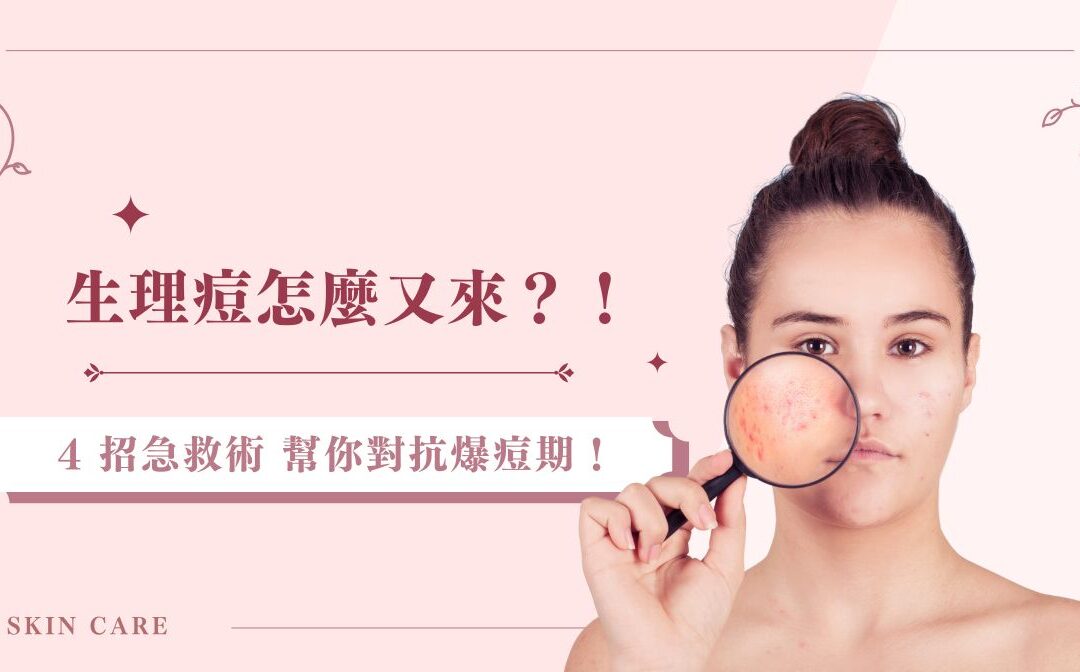 生理痘怎麼又來？！ 4 招急救術幫你對抗爆痘期！