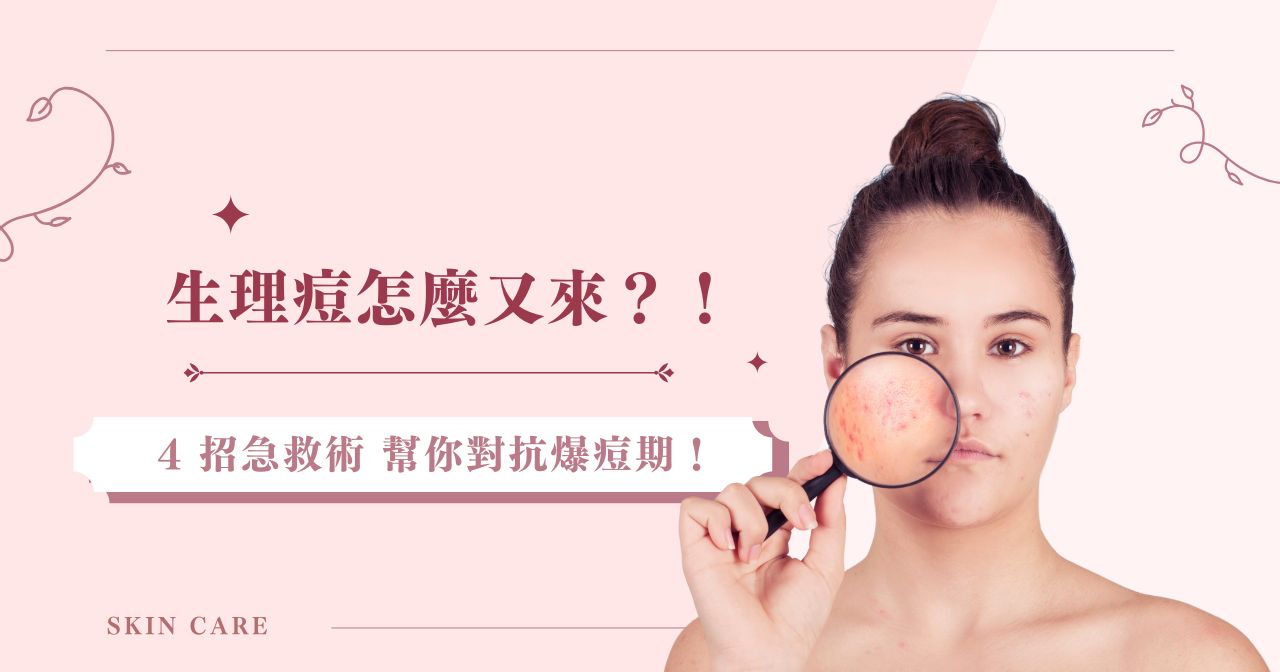 生理痘怎麼又來？！ 4招急救術幫你對抗爆痘期！
