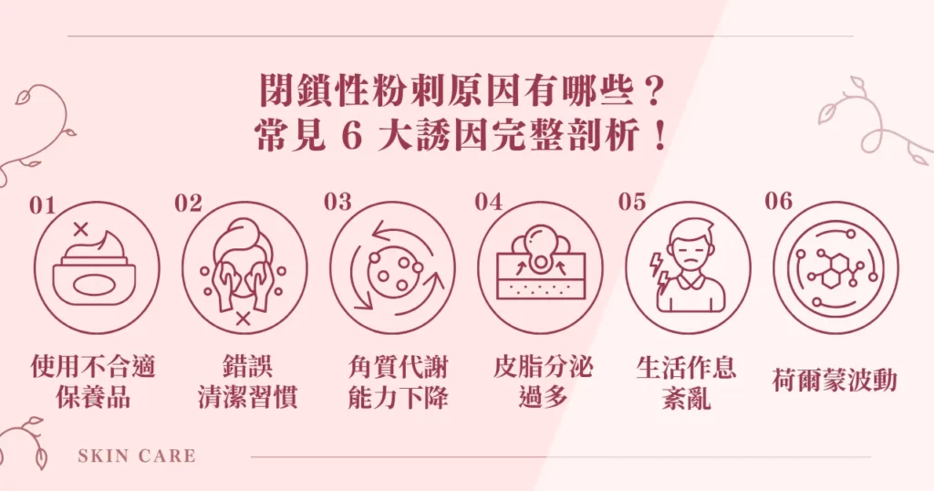 閉鎖性粉刺原因有哪些？ 常見 6 大誘因完整剖析！