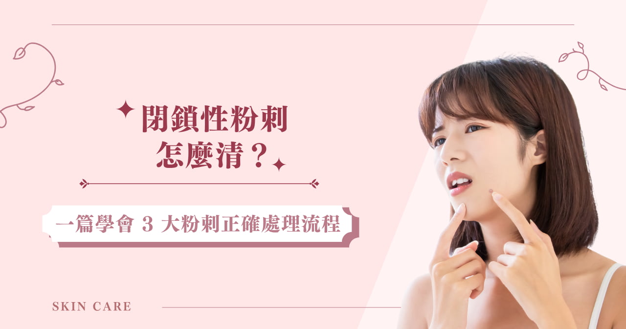 閉鎖性粉刺怎麼清？一篇學會 3 大粉刺正確處理流程！