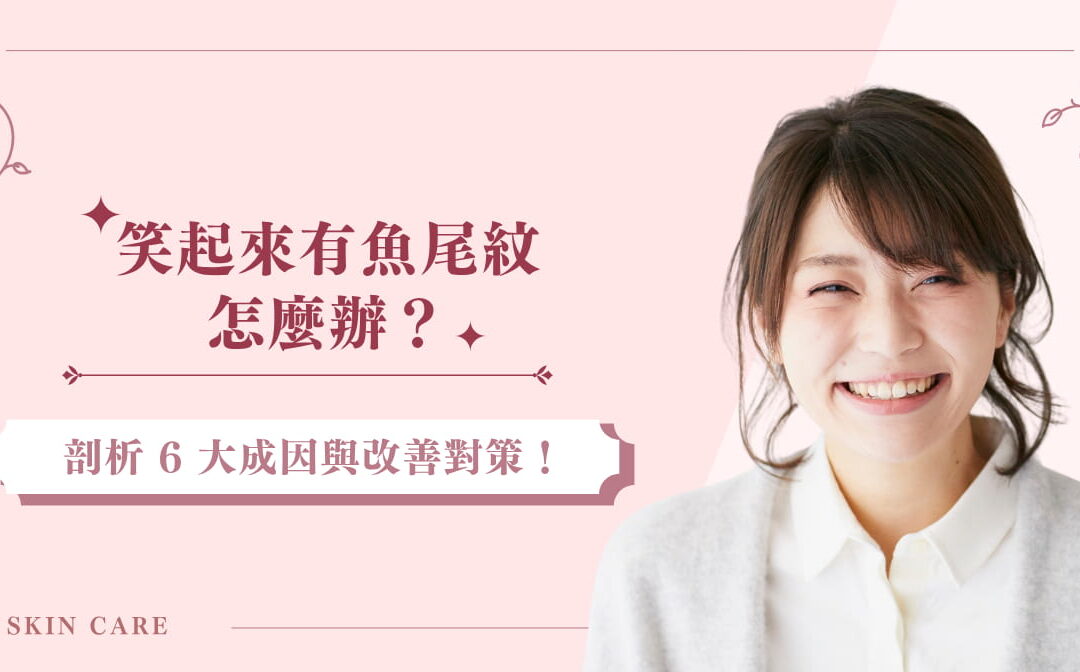 笑起來有魚尾紋怎麼辦？剖析 6 大成因與改善對策！