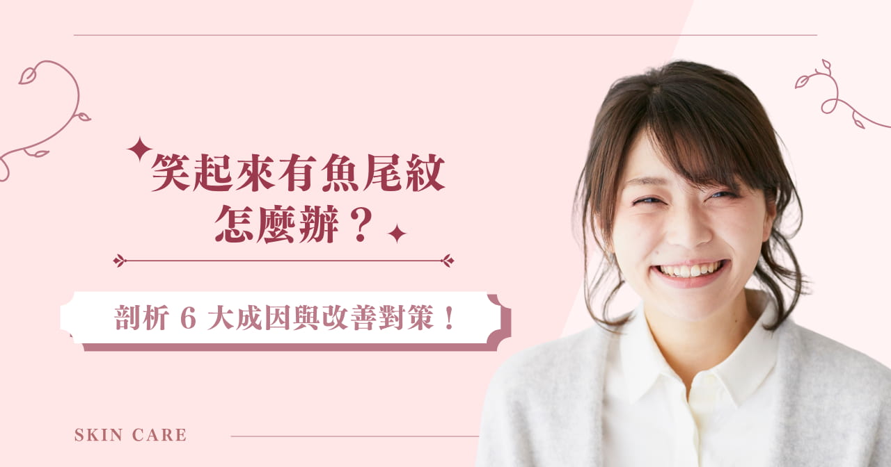 笑起來有魚尾紋怎麼辦？剖析 6 大成因與改善對策！